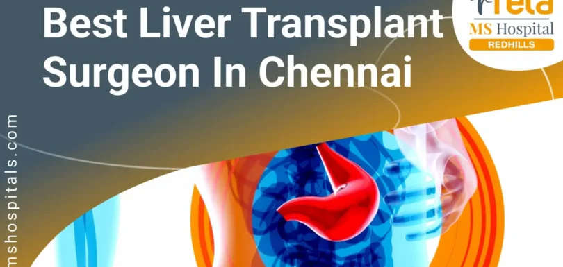 Best Liver Transplant Surgeon in Chennai