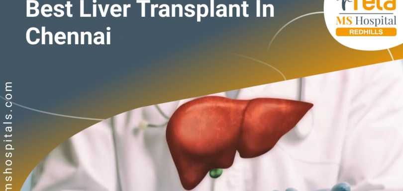 Liver Transplant in Chennai